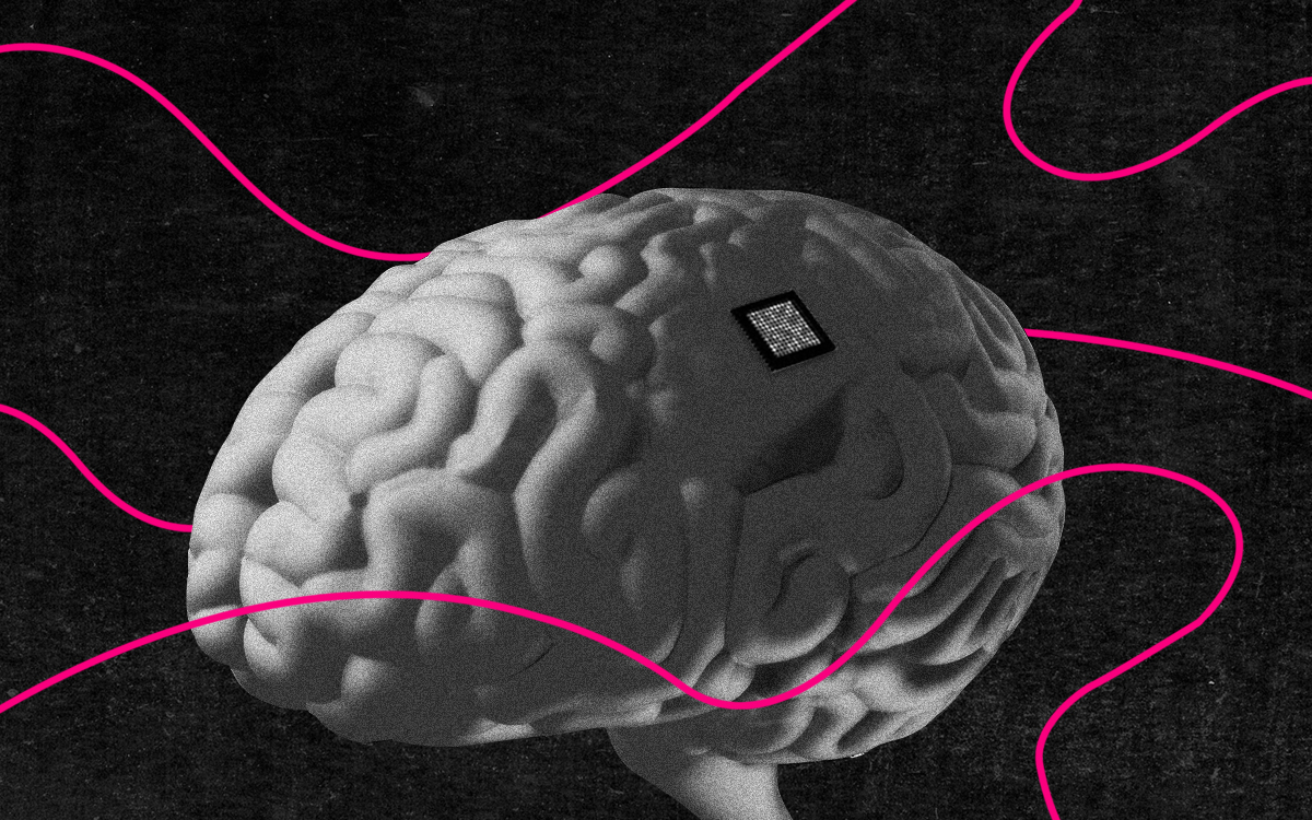 Brain Implant Successfully 