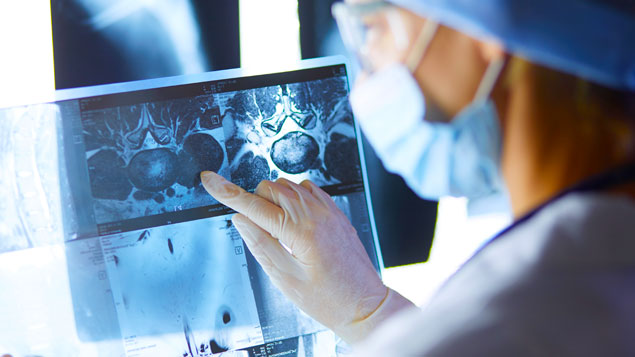 64% of Radiologists Agree With the Results of AI Algorithms